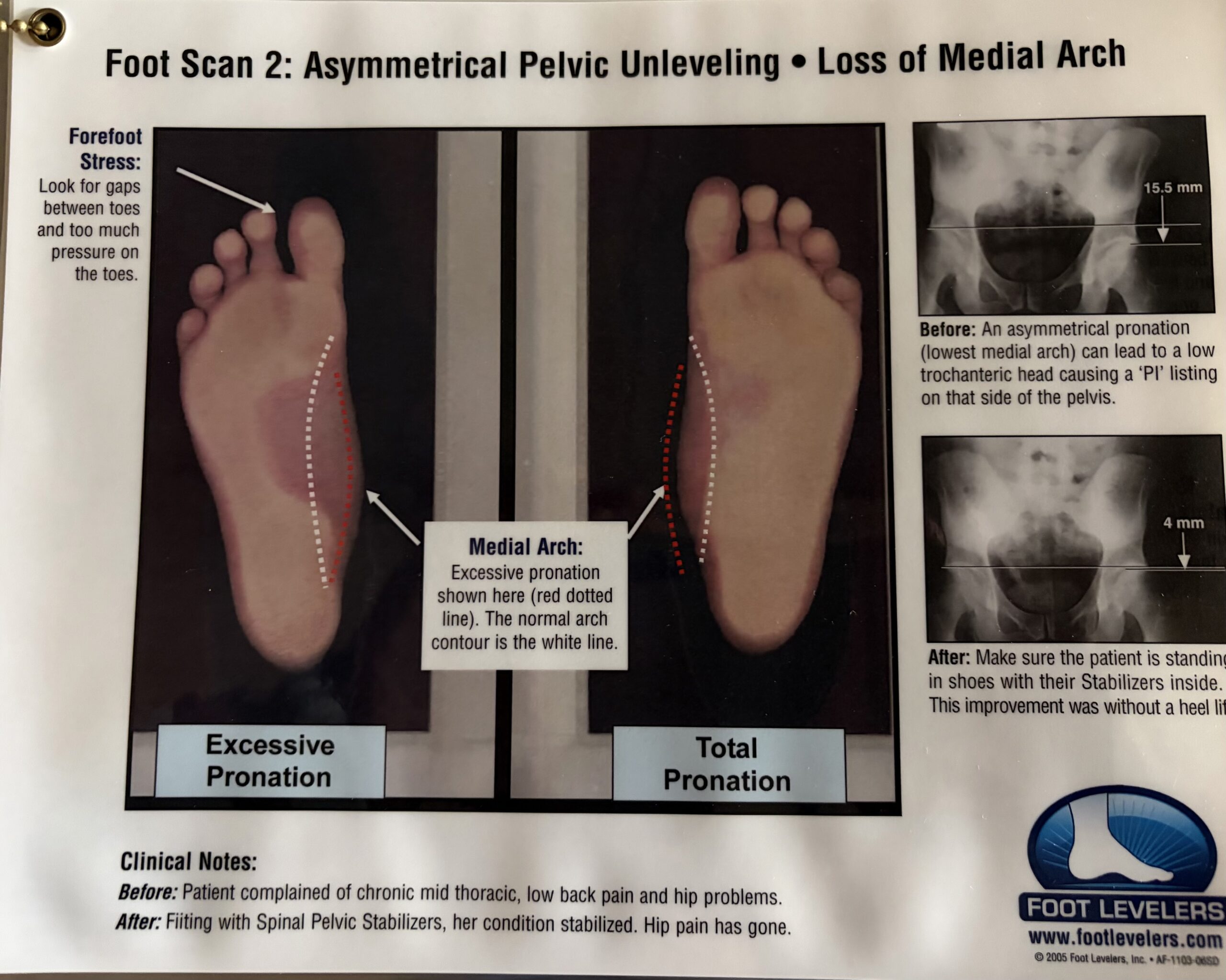 Dr. Shahnaz Sabeti performing a Foot Levelers 3D digital foot scan